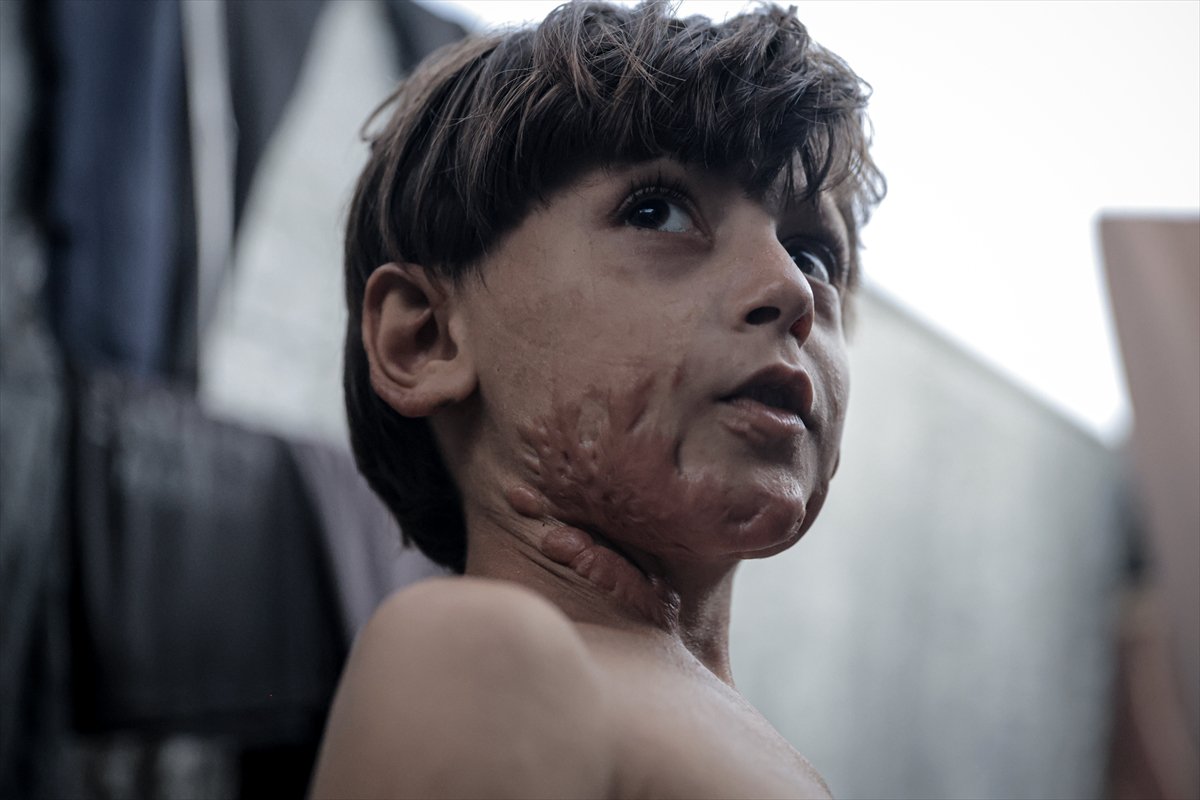 İsrail saldırısının hedefi olan çocuklardan biri: Muhammed