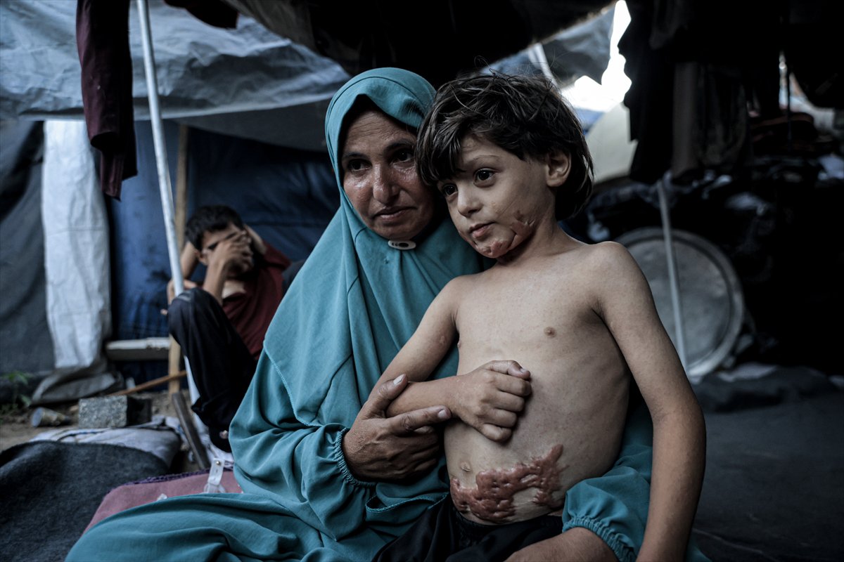 İsrail saldırısının hedefi olan çocuklardan biri: Muhammed