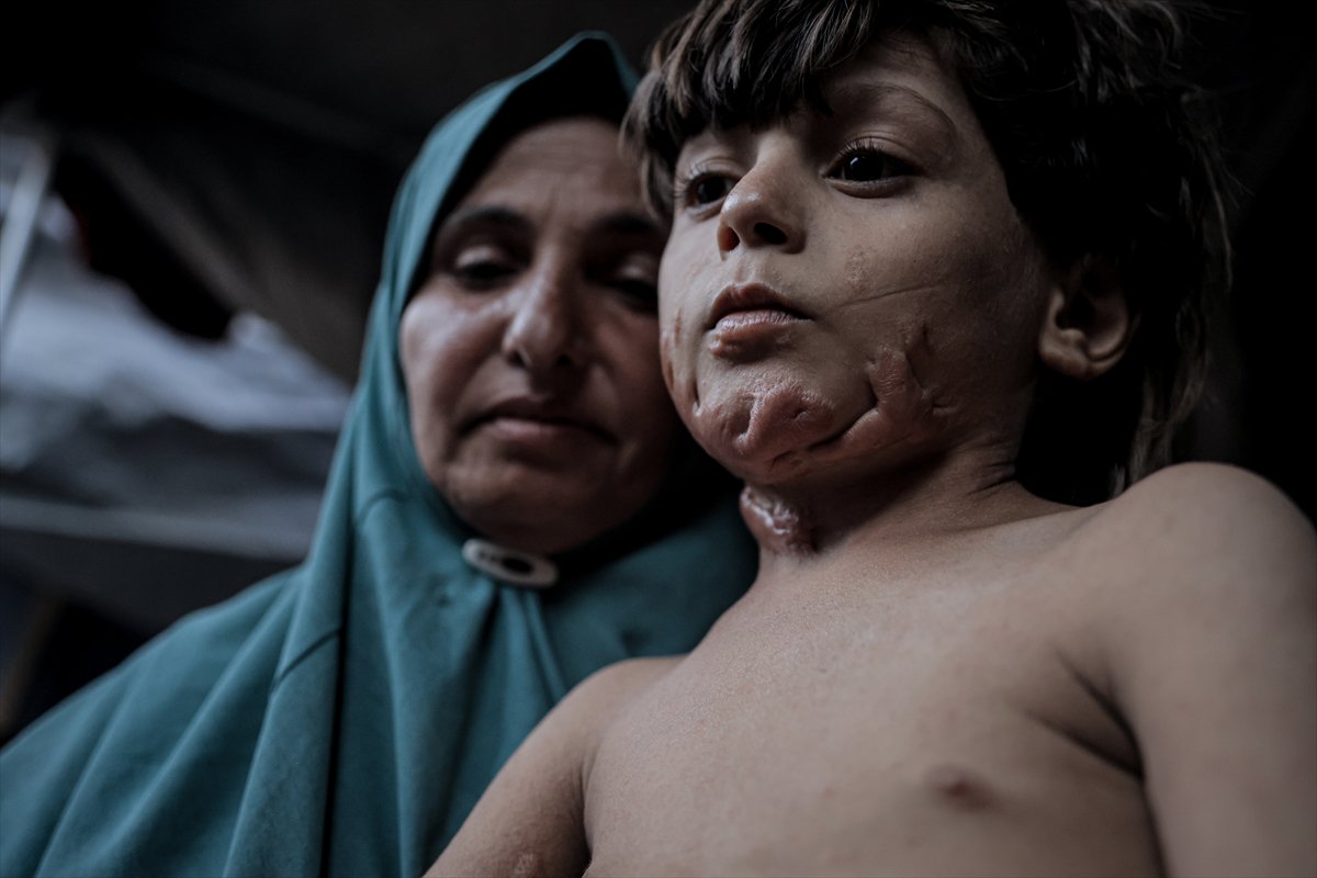 İsrail saldırısının hedefi olan çocuklardan biri: Muhammed