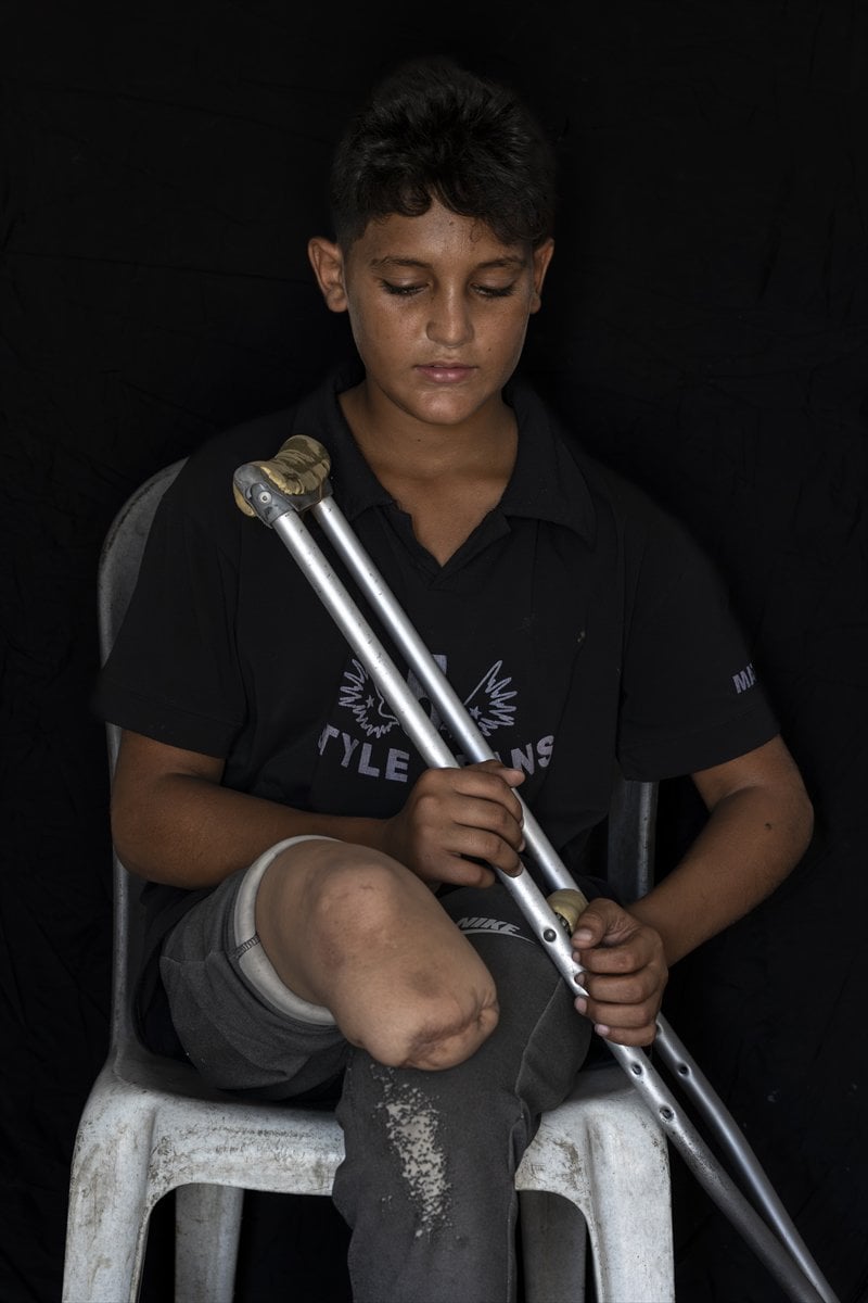 Gazze'de binlerce çocuk İsrail saldırılarında uzuvlarını kaybetti