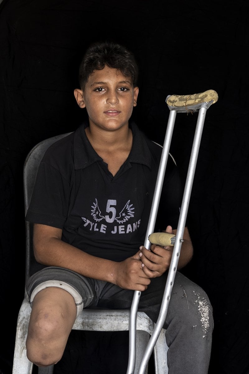 Gazze'de binlerce çocuk İsrail saldırılarında uzuvlarını kaybetti