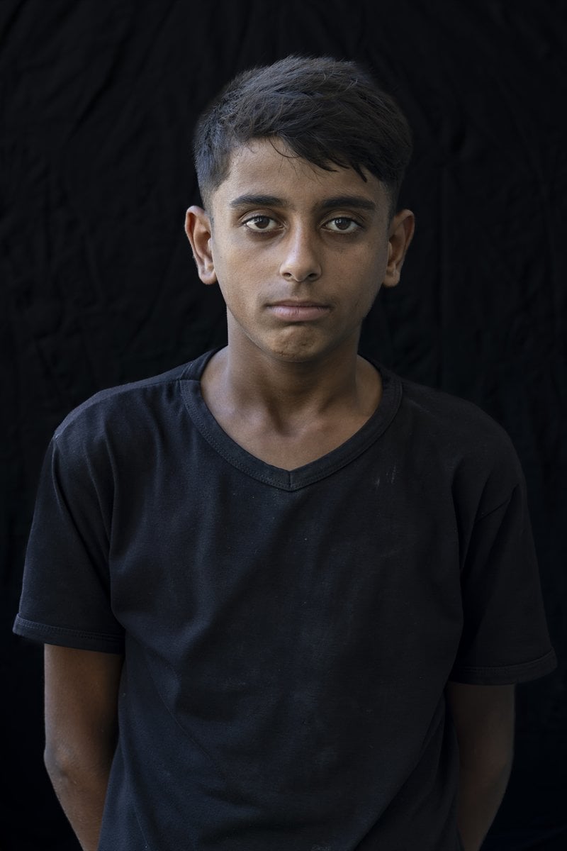 Gazze'de binlerce çocuk İsrail saldırılarında uzuvlarını kaybetti