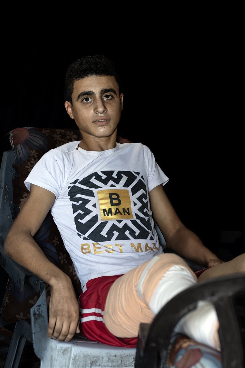 Gazze'de binlerce çocuk İsrail saldırılarında uzuvlarını kaybetti