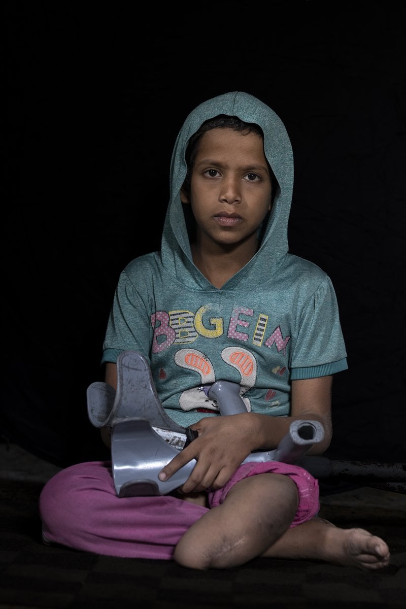 Gazze'de binlerce çocuk İsrail saldırılarında uzuvlarını kaybetti