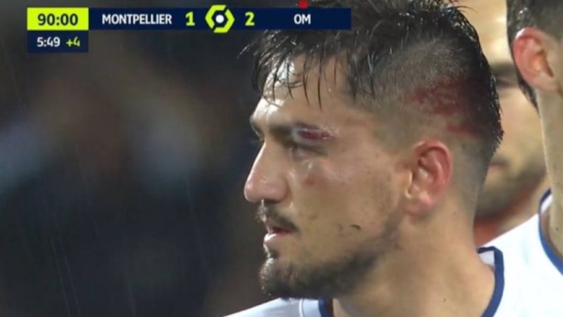 Montpellier maçında kaşı açılan Cengiz Ünder son durumunu paylaştı