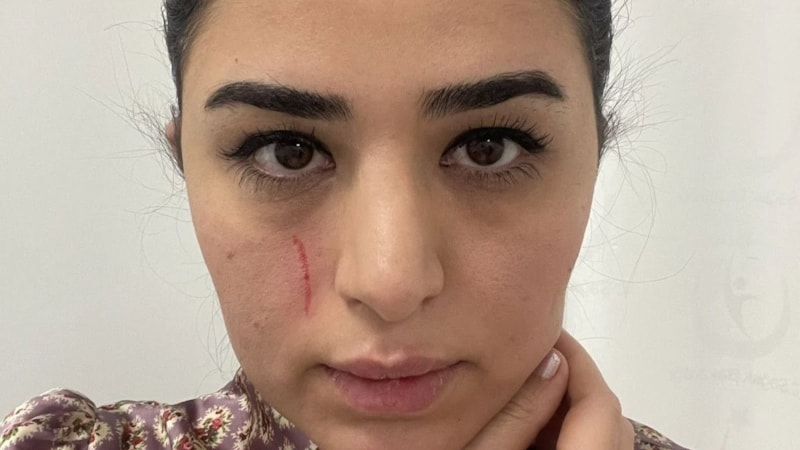 Mersin'de kadın doktoru darbeden iki sanık serbest kaldı