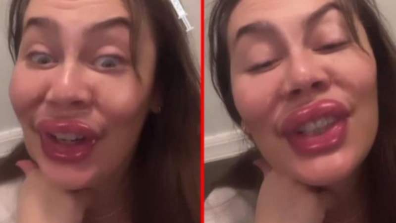 Demet Evgar, botoks ve dolguyu fazla kaçıranları ti’ye aldı