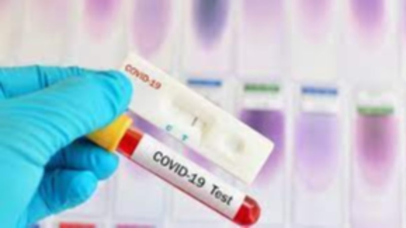 Koronavirüs test sonucu ne zaman çıkar? Koronavirüs (Covid-19) test sonucu çıkma süresi