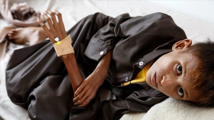 a Yemen’deki iç savaş 8 yıldır sürüyor