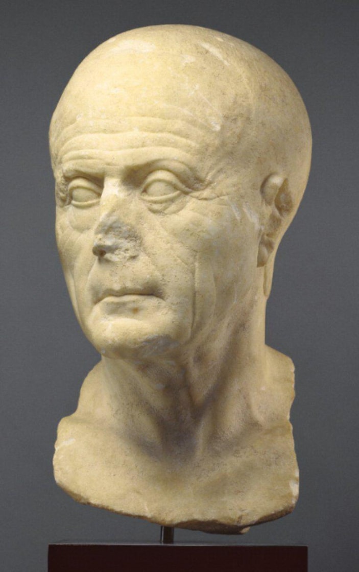 Vakanüvis yazdı: Saç ekimi bizde başladı