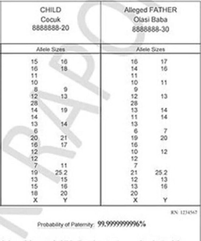 Doğuş'un babalık testi sonucu belli oldu