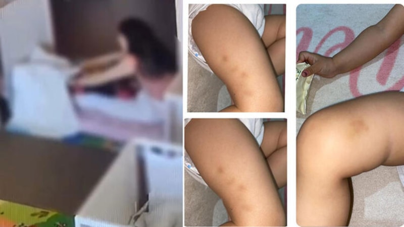 Zeytinburnu'nda çocuğa kreşte darp iddiası: 2 görevli suçlamayı kabul etmedi