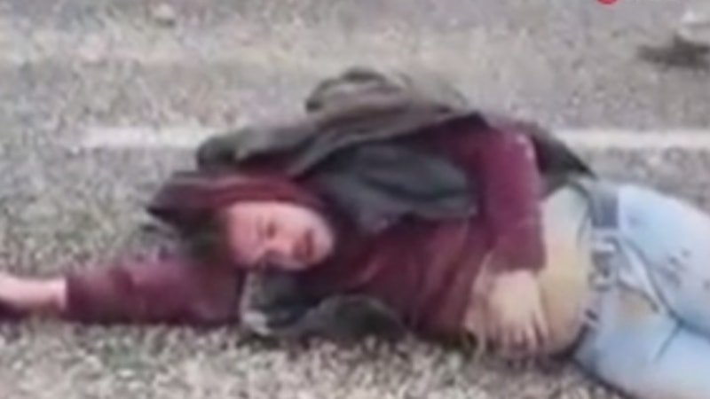 Gaziantep'te kaza yaptı, ‘yüzümde şişlik var mı’ diye sordu