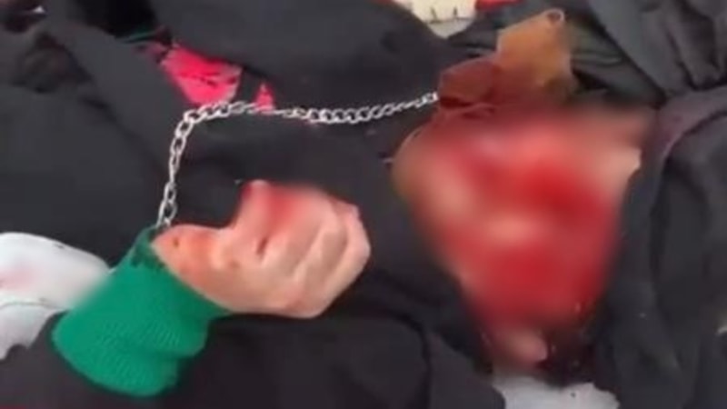 Sakarya'da sokak ortasında eski eşinin bıçaklı saldırısına uğrayan kadın tek gözünü kaybedebilir