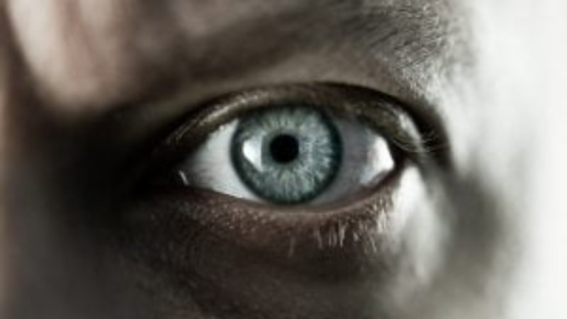 Göz seyirmesinin aslında hurafelerle hiç alakası olmayan 3 tipik sebebi