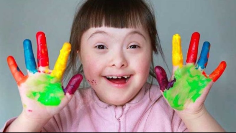 Birbirinden anlamlı Down Sendromu Günü mesajları ve sözleri! Kısa ve uzun Down Sendromu Günü mesajları