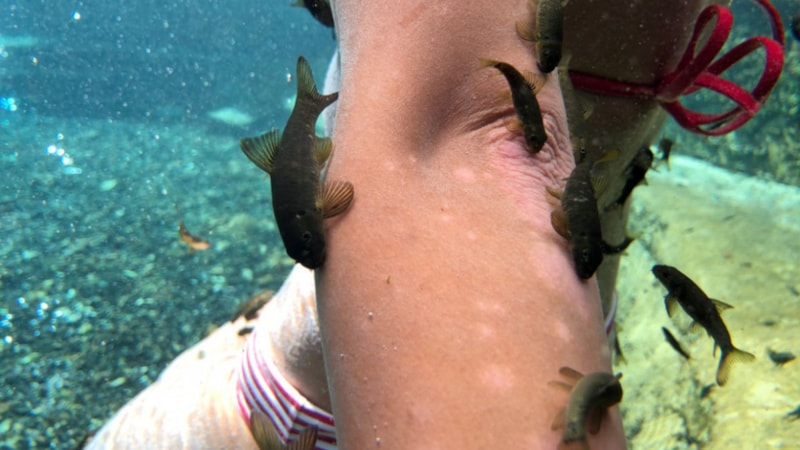 Sivas'ta sedef hastalığı tedavisinde kullanılan balıklar sel tehdidiyle karşı karşıya