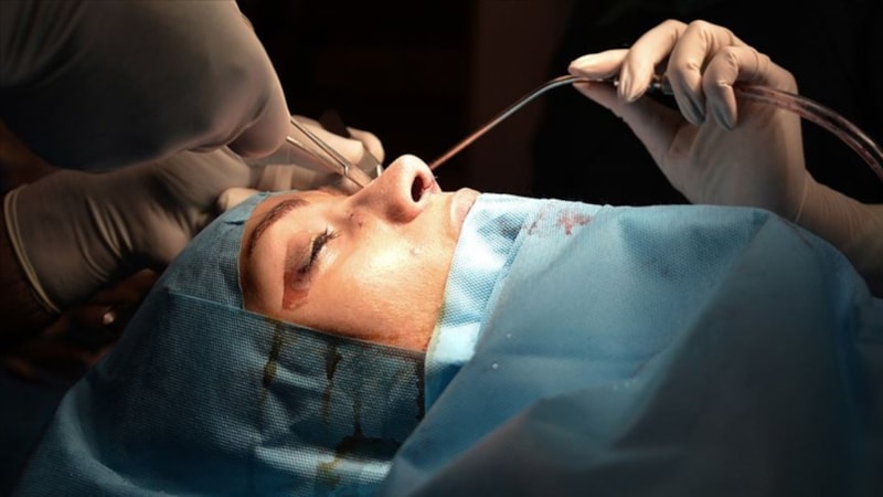 Estetik caiz mi? İşte Diyanetin ayetlerle açıkladığı fetva