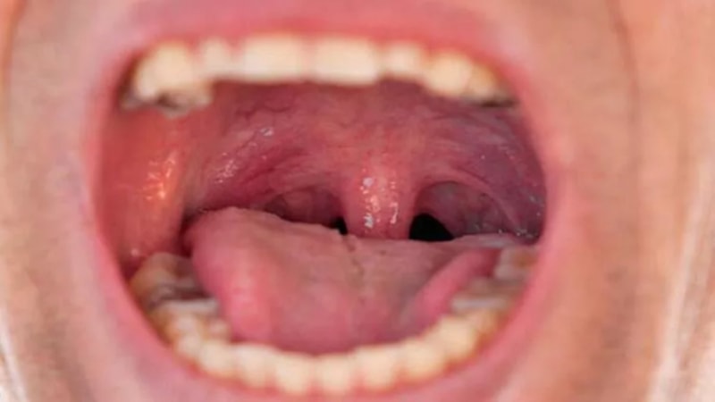 Düşündüğünüz gibi değil! Ses telleri bakın nasıl görünüyor...