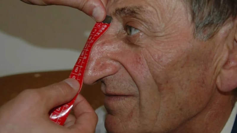 Dünyanın en uzun burunlu insanı Mehmet Özyürek'e veda