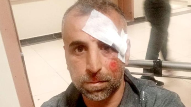 Adıyaman'da sokak köpeği saldırdığı iki kişiyi yaraladı