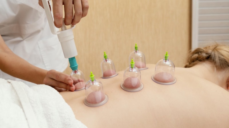 Acısı yok, şifası çok! İşte hacamat öncesi ve sonrası dikkat edilmesi gerekenler