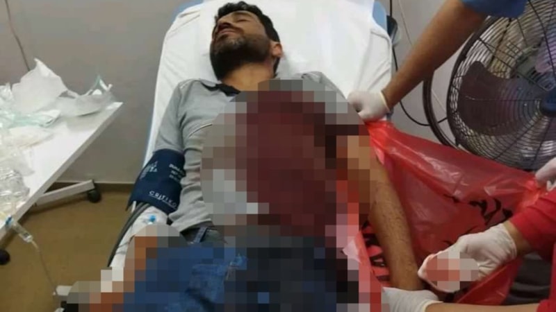 Kocaeli'de elektrik sayacı okuyan personel köpek saldırısında yaralandı