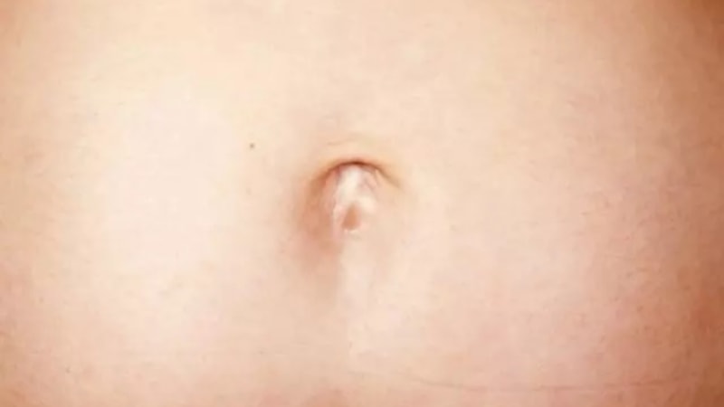 Şaka değil gerçek! Göbek deliğinize yara bandı yapıştırırsanız...
