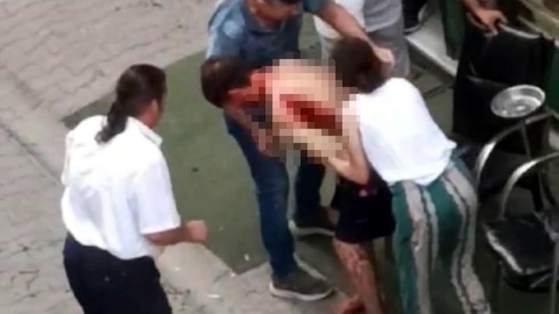Tekirdağ'da bina sakini ile yönetici arasında bıçaklar konuştu: 1 yaralı