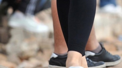 Varis hastalığı ile ilgili tüm detaylar! Sıcak havalar varis hastalığını tetikliyor