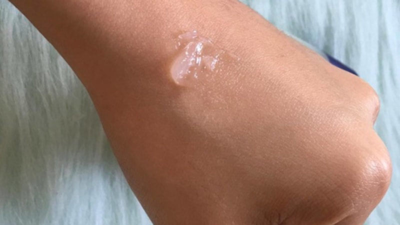 Stilex Jel nedir, ne işe yarar? Stilex kaşıntıya iyi gelir mi? FİYATI 2023!