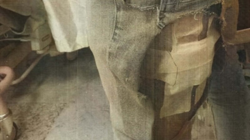 İzmir'de sokak köpeği saldırısı! Avukatın tazminat talebi mahkemeden sonuçlandı