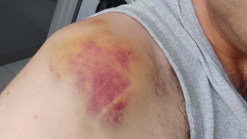 Manisa'da iki aile arasında çocuk kavgası: 3 yaralı