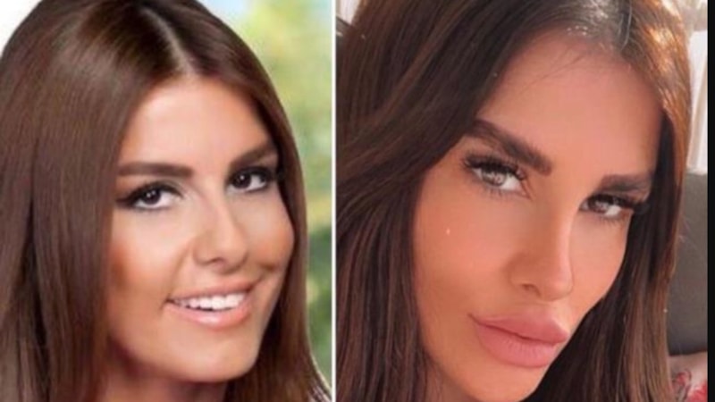 Tuğçe Özbudak sağlık durumuyla ilgili bilgi verdi