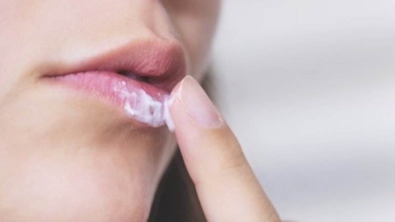 Aklovir krem nedir, ne işe yarar? Aklovir nereye sürülür? Aklovir fiyatı 2023!