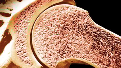 Kemiklerini seven her gün içsin! Boşlukları kolajenle dolduruyor...