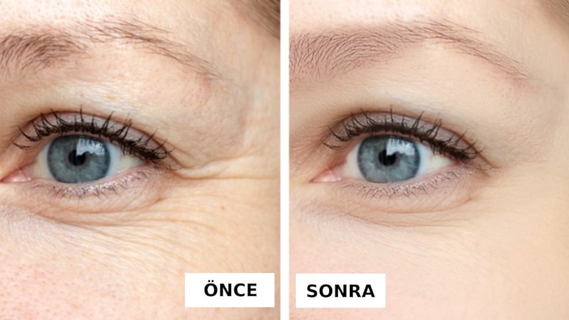 Gece sürün, huzurla uyuyun… Uyandığınızda kaz ayaklarından eser kalmayacak!