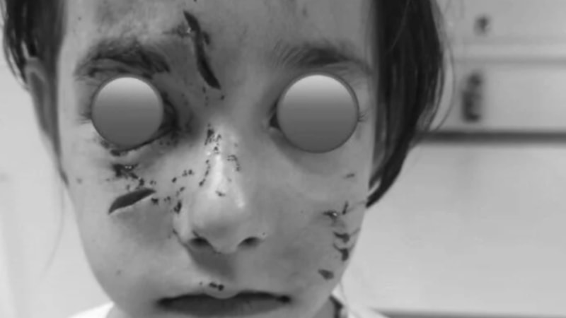 İstanbul Valiliği'nden küçük çocuğa köpek saldırısıyla ilgili açıklama