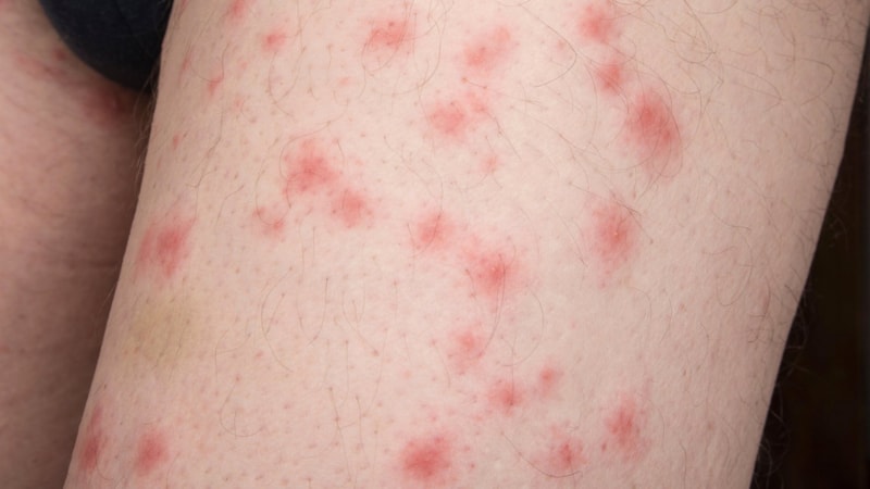 Paris'te tahtakurusu alarmı