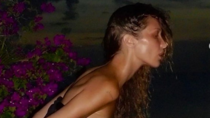 Bella Hadid, iyileşti