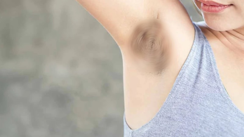 İstenmeyen kararmalara son! Bu tarifleri uygulayanların yüzü gülecek...