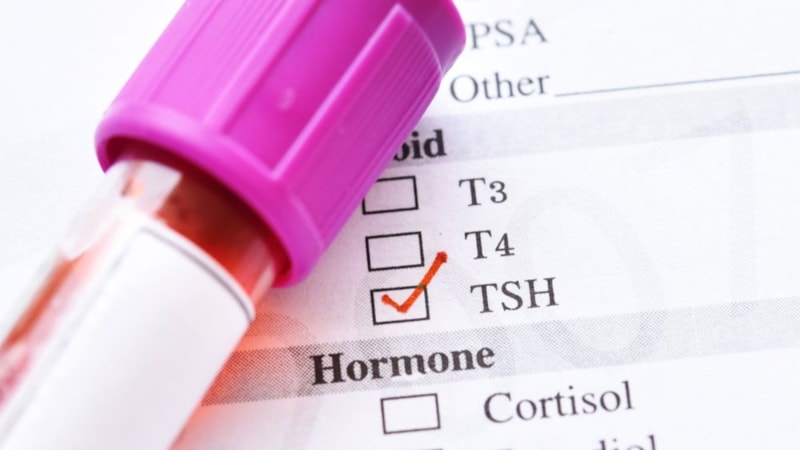 TSH değeri en düşük/yüksek kaç olmalıdır? Eğer 5 ve üzeri ise...