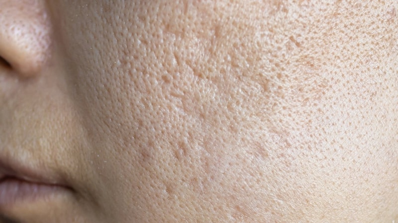 Cilt ömrünü kısaltan hatalar! Siz de yapıyor olabilirsiniz...