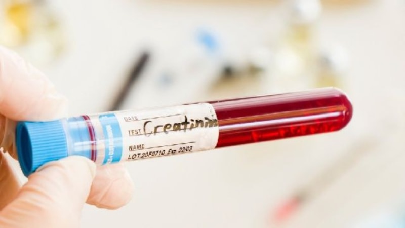 Kreatinin yüksekliği/düşüklüğü neyi gösterir? Kaç olursa diyalize girilir?