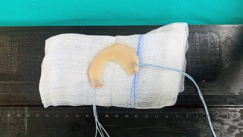 Samsun'da halı sahada dizini sakatladı! Menisküs nakli ameliyatı yapıldı...