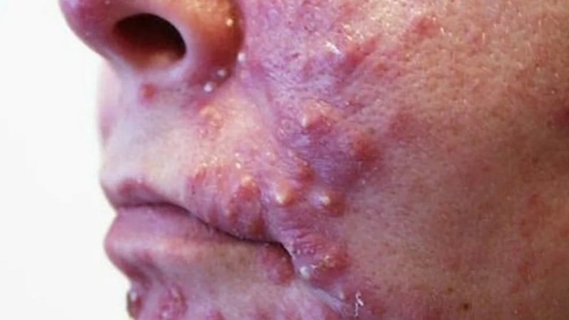 Bunu yapan yandı! Ölüme götüren bu hareketi sizde yapıyor olabilirsiniz...