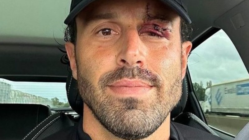 Lyon çalıştırıcısı Fabio Grosso'nun yaralandığı olaylarda 9 kişi gözaltına alındı