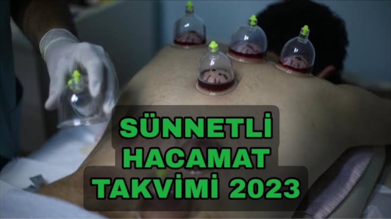 Sünnetli Hacamat Günleri 2023: Kasım ayında hangi günler yapılmalı