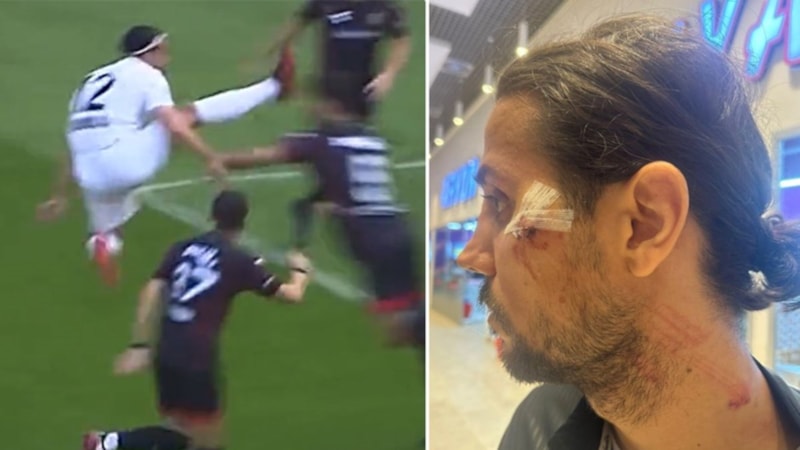 2. Lig'e damga vuran pozisyon! Hakemden olay karar