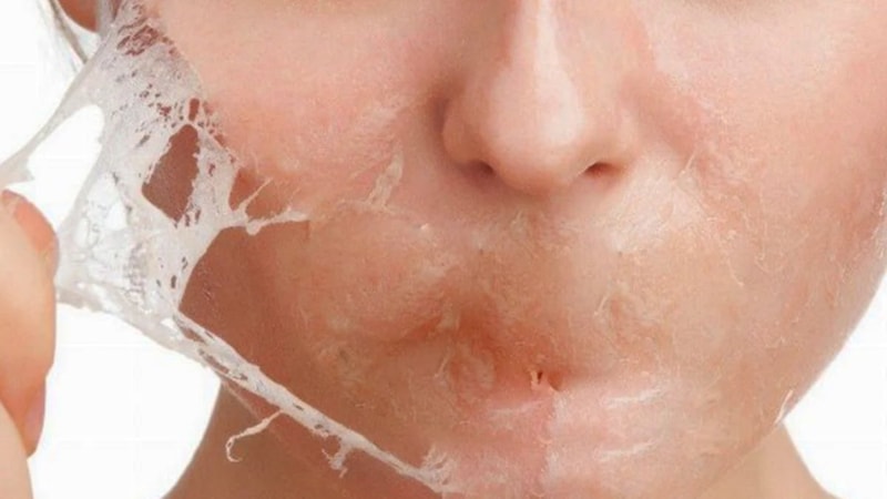 Cildine bunu yapanlar yandı! Cildiniz yanabilir...